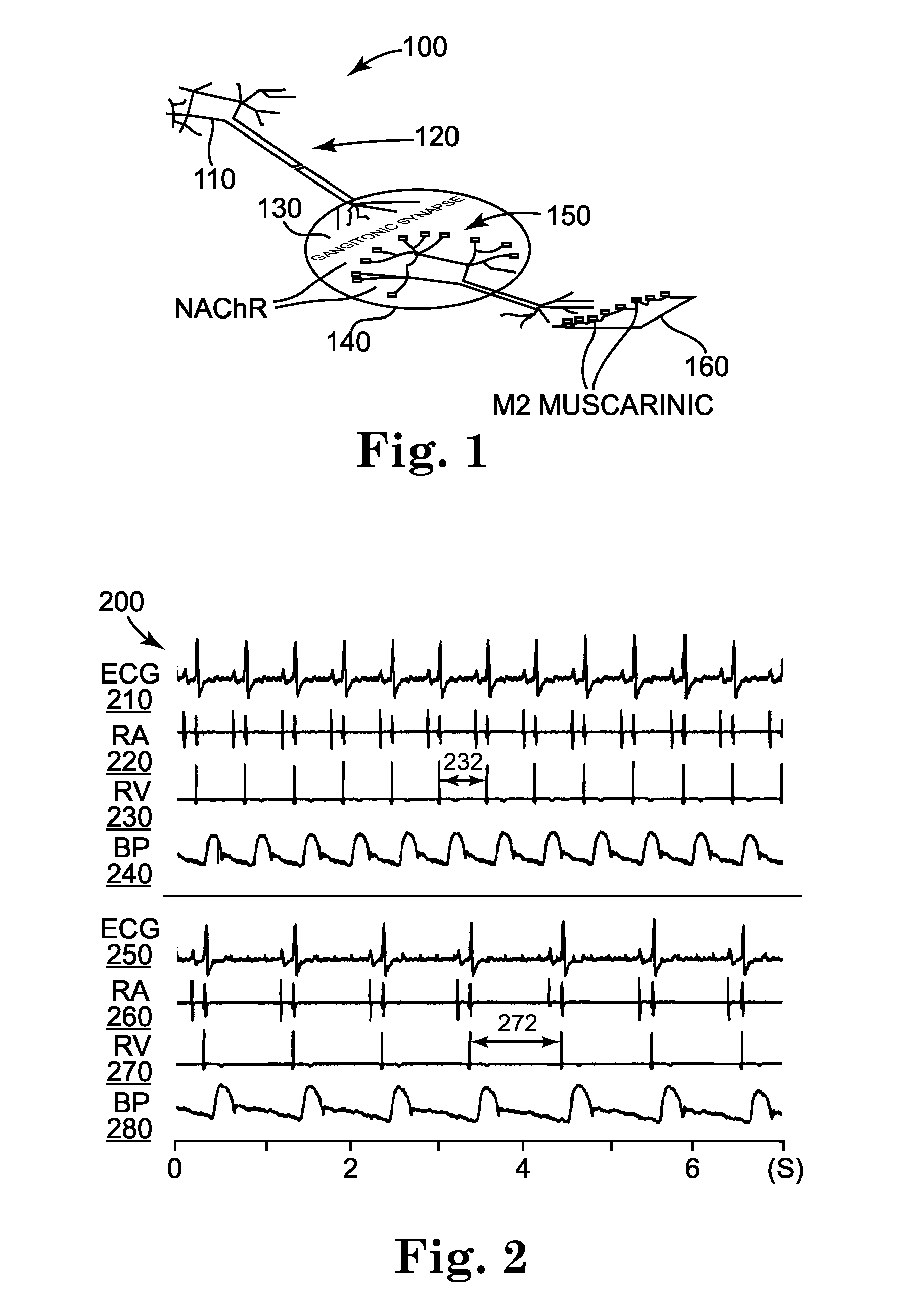 Treatment of Cardiac Arrhythmia by Modification of Neuronal Signaling Through Fat Pads of the Heart