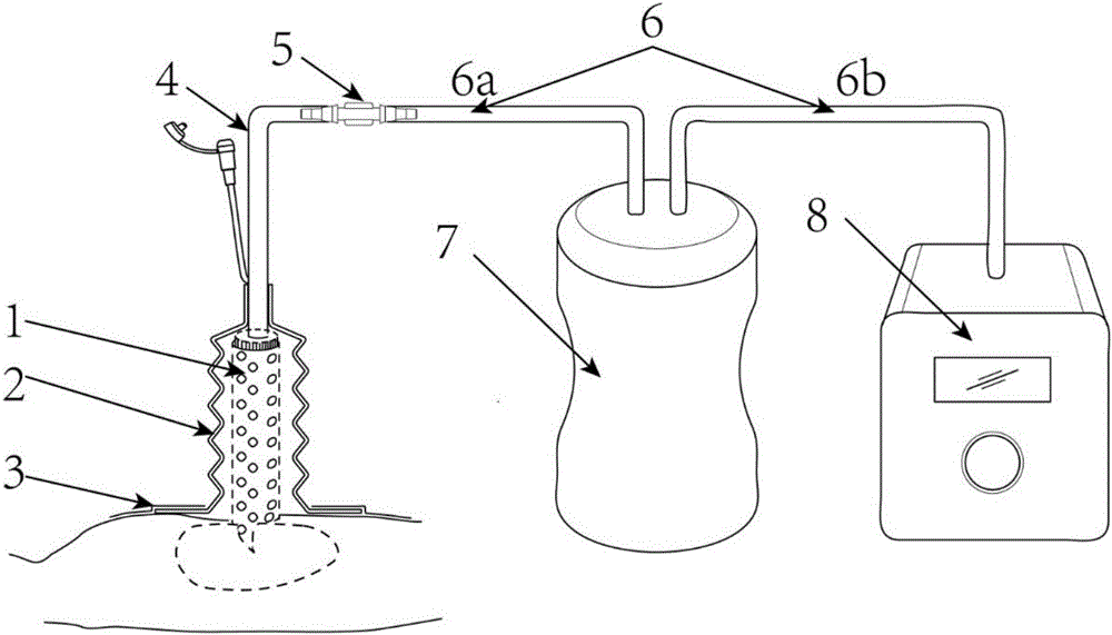 Negative pressure sealing drainage system for deep cavity wound surface operation nursing