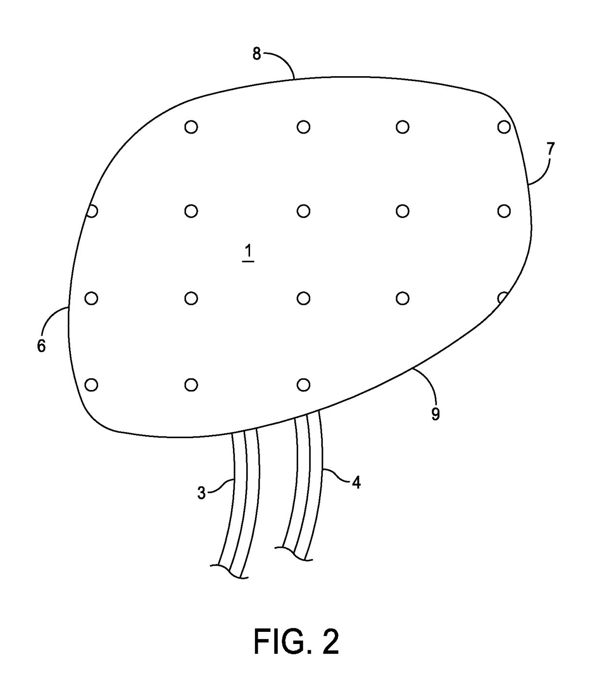 Action/counteraction superimposed double chamber broad area tissue ablation device