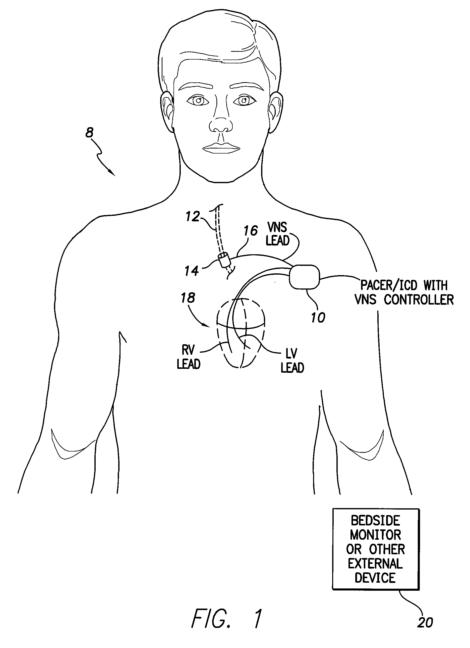 Systems and Methds for Use by an Implantable Medical Device for Controlling Vagus Nerve Stimulation Based on Heart Rate Reduction Curves and Thresholds to Mitigate Heart Failure