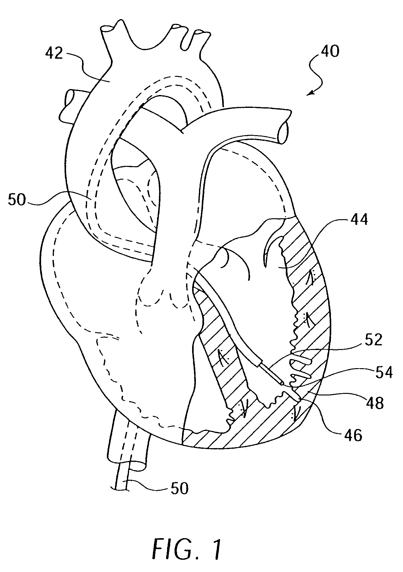 Elongated medical device with functional distal end