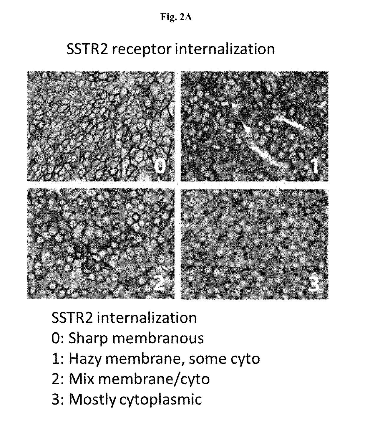 Sstr-targeted conjugates and particles and formulations thereof