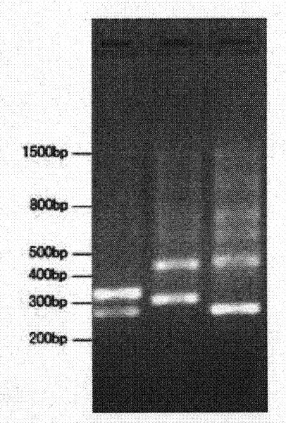 Primer for detecting dynamic mutation of CAG repetitive sequence of ATXN3 gene and PCR amplification method thereof