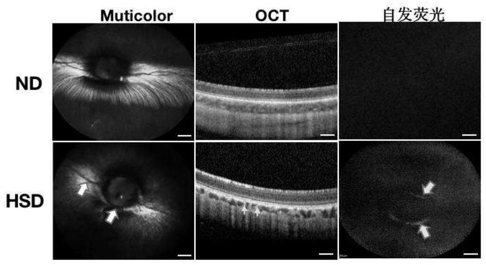 High-sugar diet induced early-stage dry age-related macular degeneration pigment rabbit model