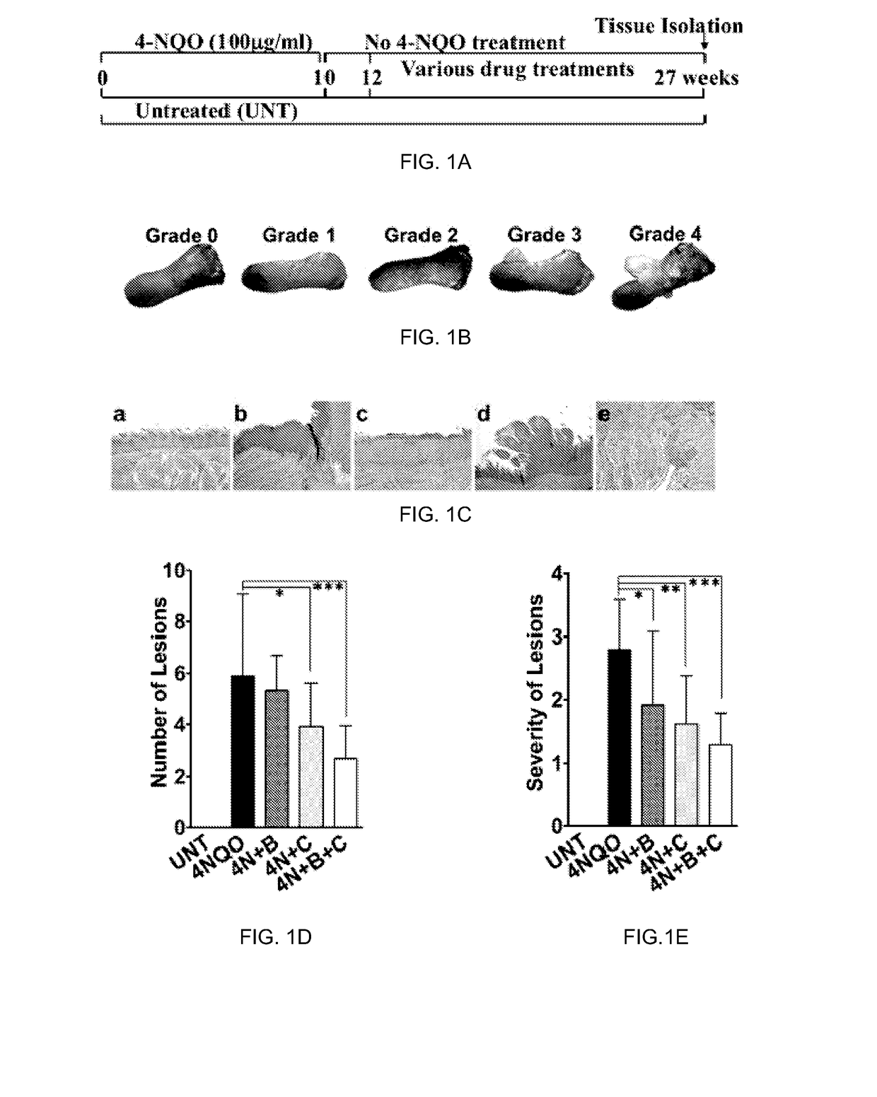 Combination therapy for head and neck cancer