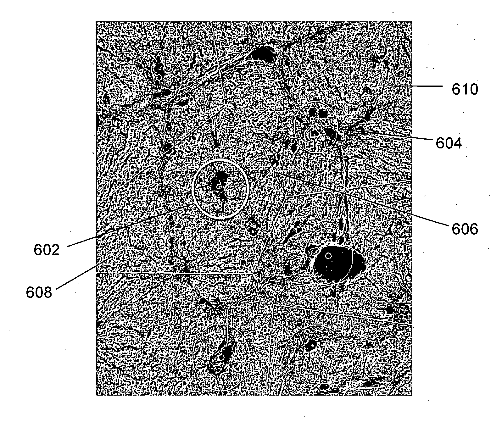 Method and system for determining a stage of fibrosis in a liver