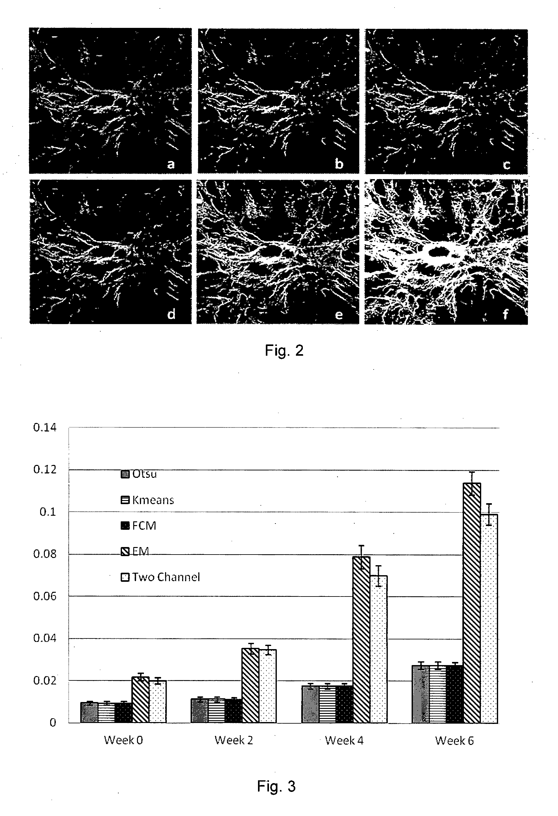 Method and system for determining a stage of fibrosis in a liver