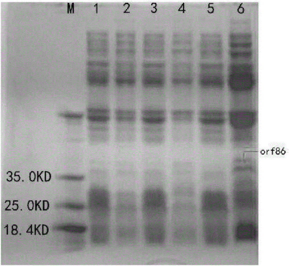 AMP (antimicrobial peptide) fusion protein as well as preparation method and application thereof