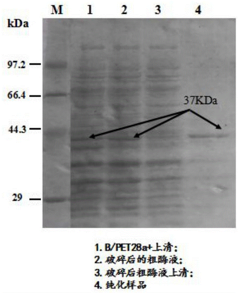 Genetically engineered bacterium expressing microorganism cholesterol esterase and construction method thereof