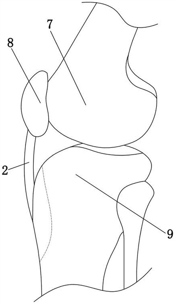 Bone-patellar tendon-bone graft structure and preparation method thereof