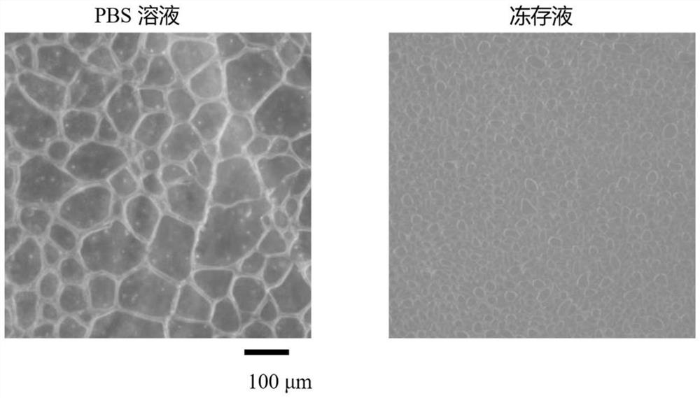 Cryopreservation liquid, preparation method thereof and application of cryopreservation liquid in human normal hepatocytes