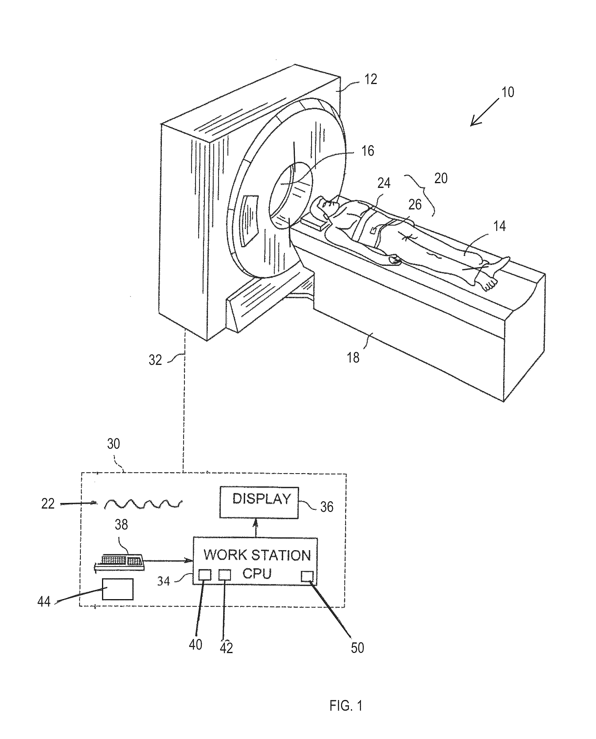 Method and apparatus for data selection for positron emission tomogrpahy (PET) image reconstruction