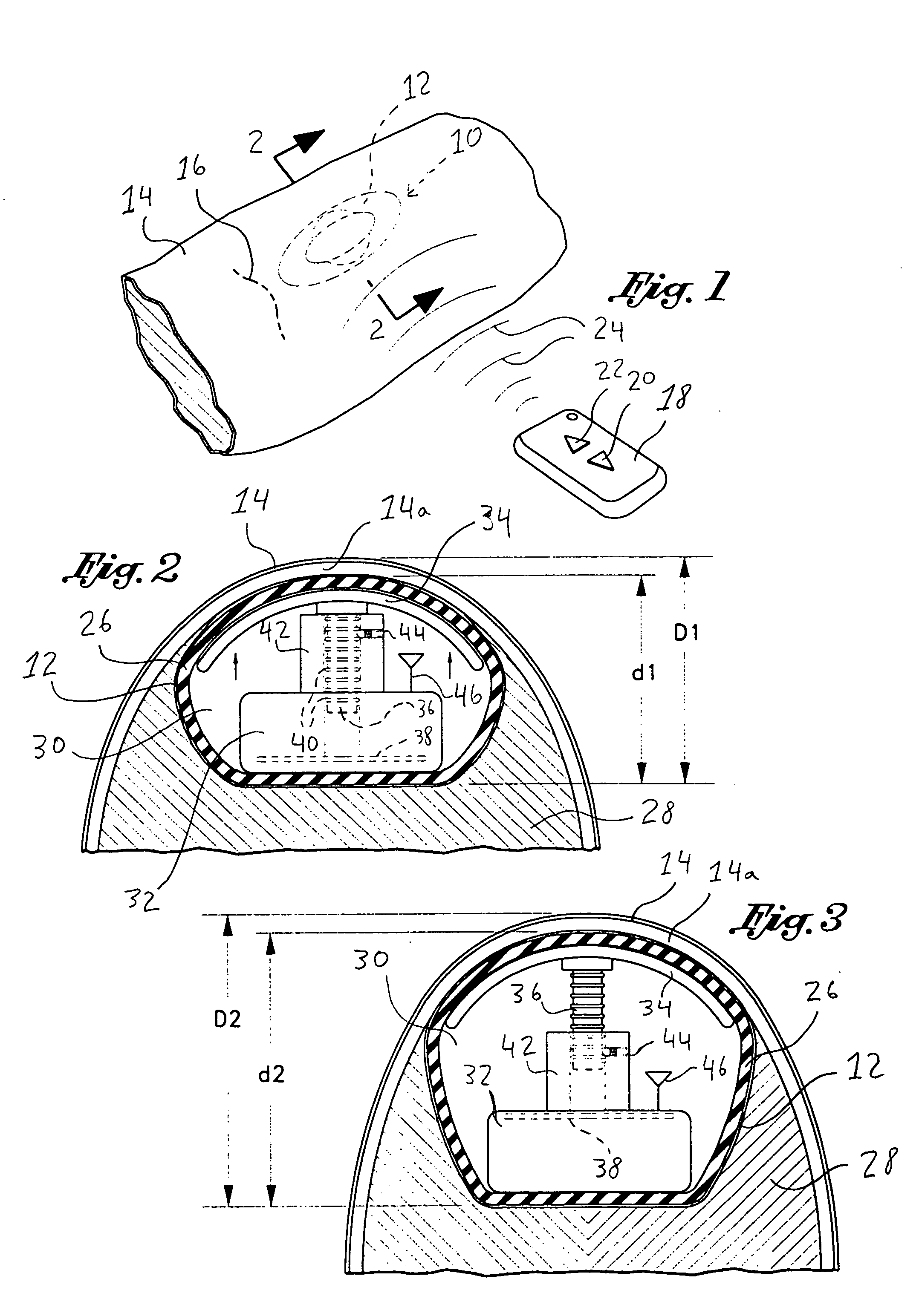 Tissue expander, system and method