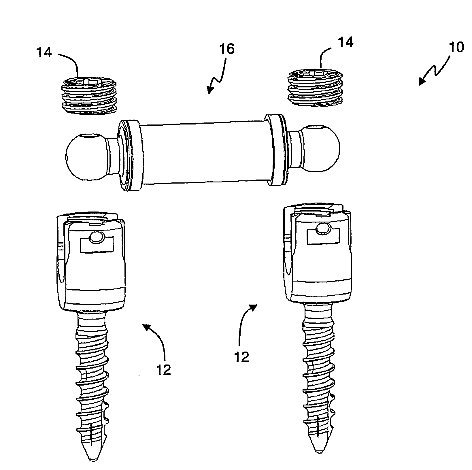 Systems and methods for dynamic spinal stabilization