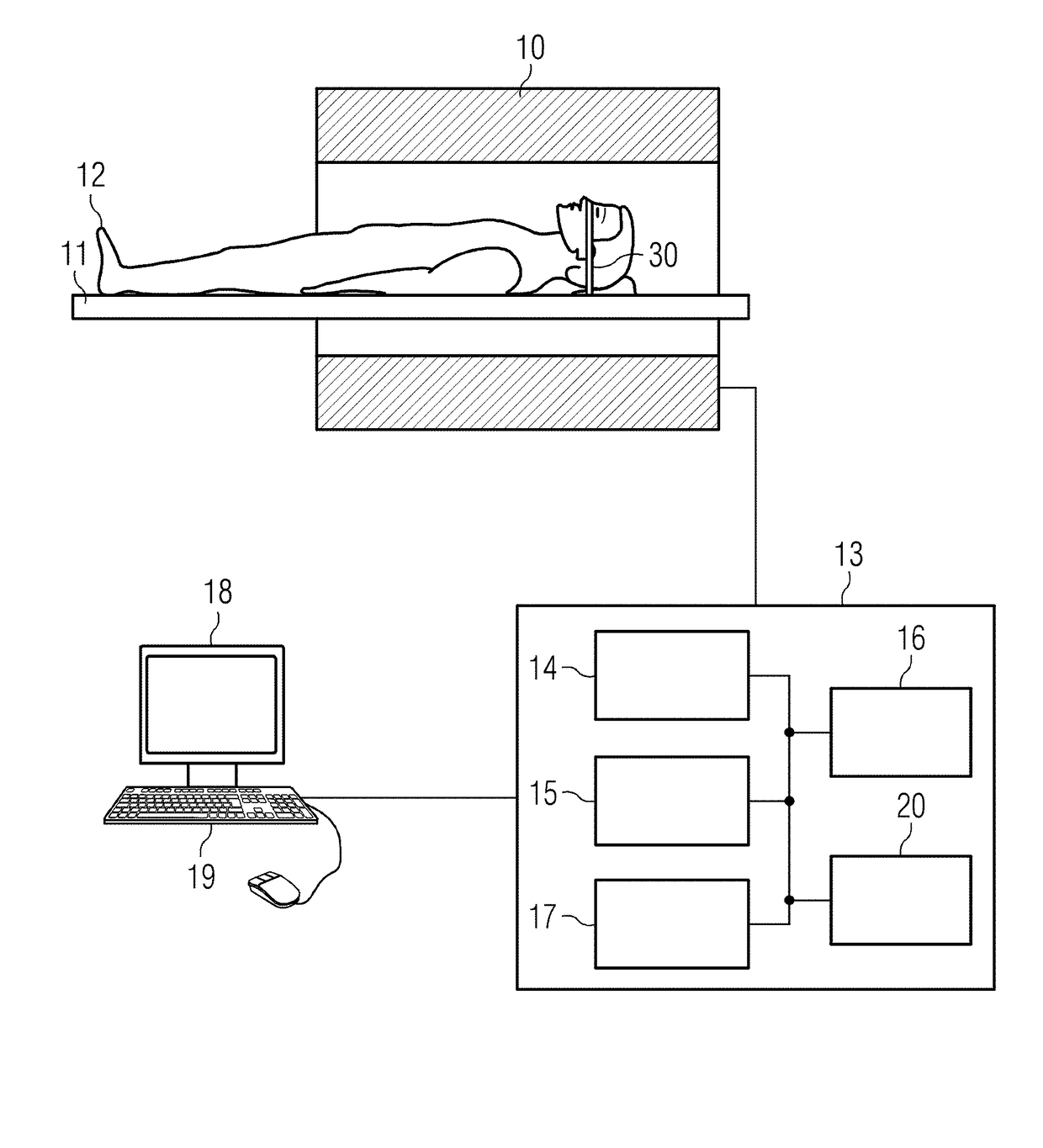 Magnetic resonance apparatus and method for vascular imaging