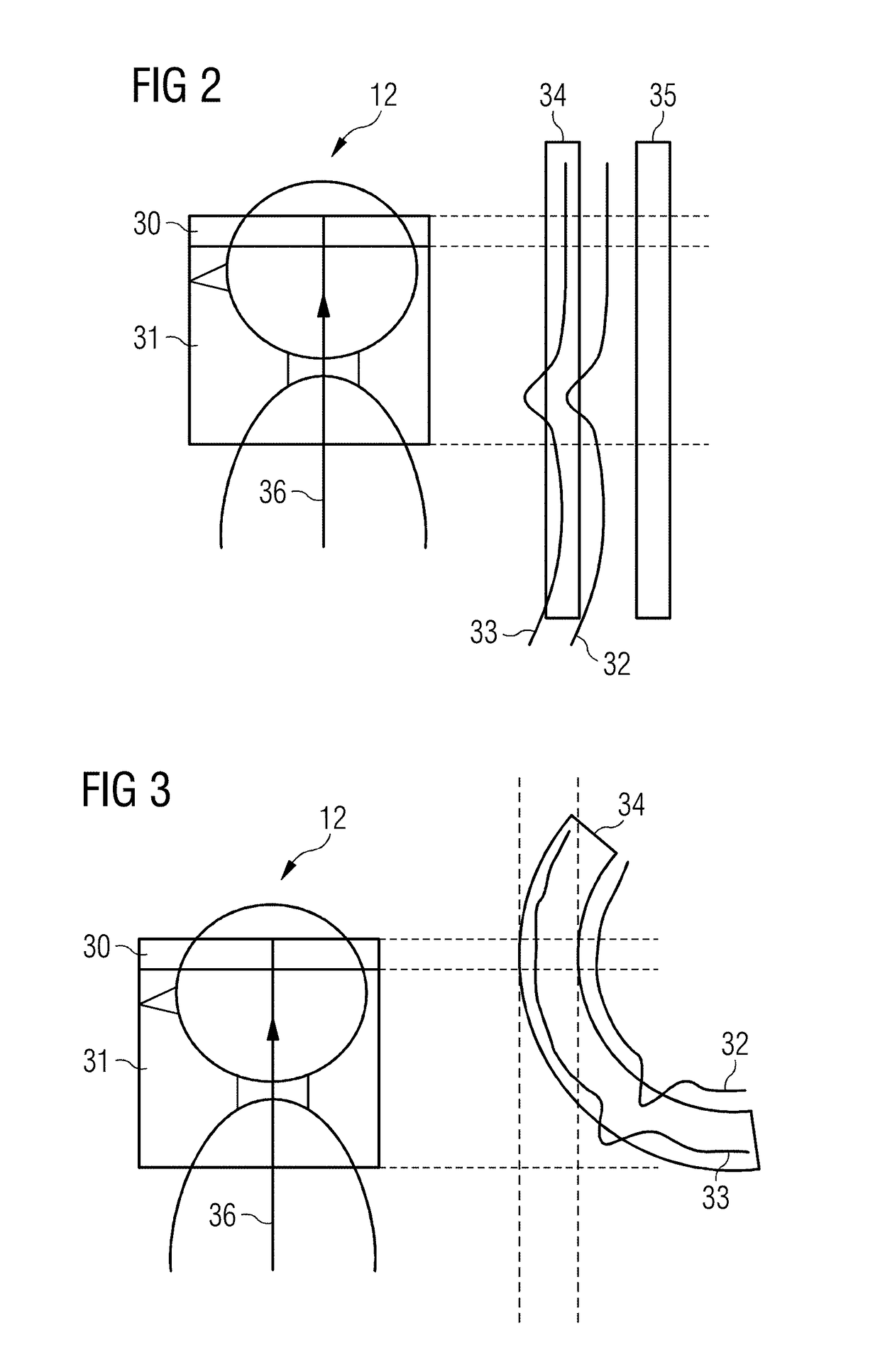 Magnetic resonance apparatus and method for vascular imaging