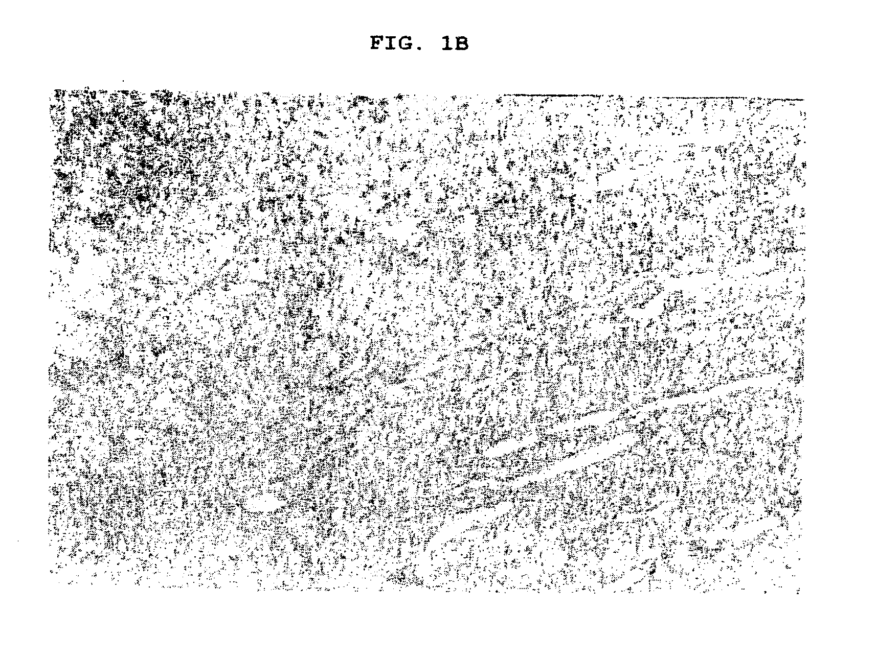 Pharmaceutical composition for treatment of wounds containing blood plasma or serum