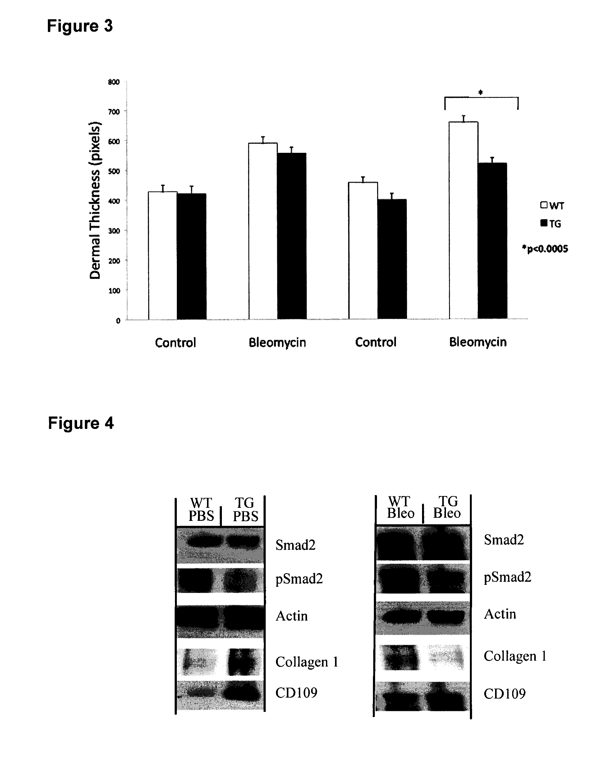 Cd109 polypeptides and uses thereof for the treatment of skin cells