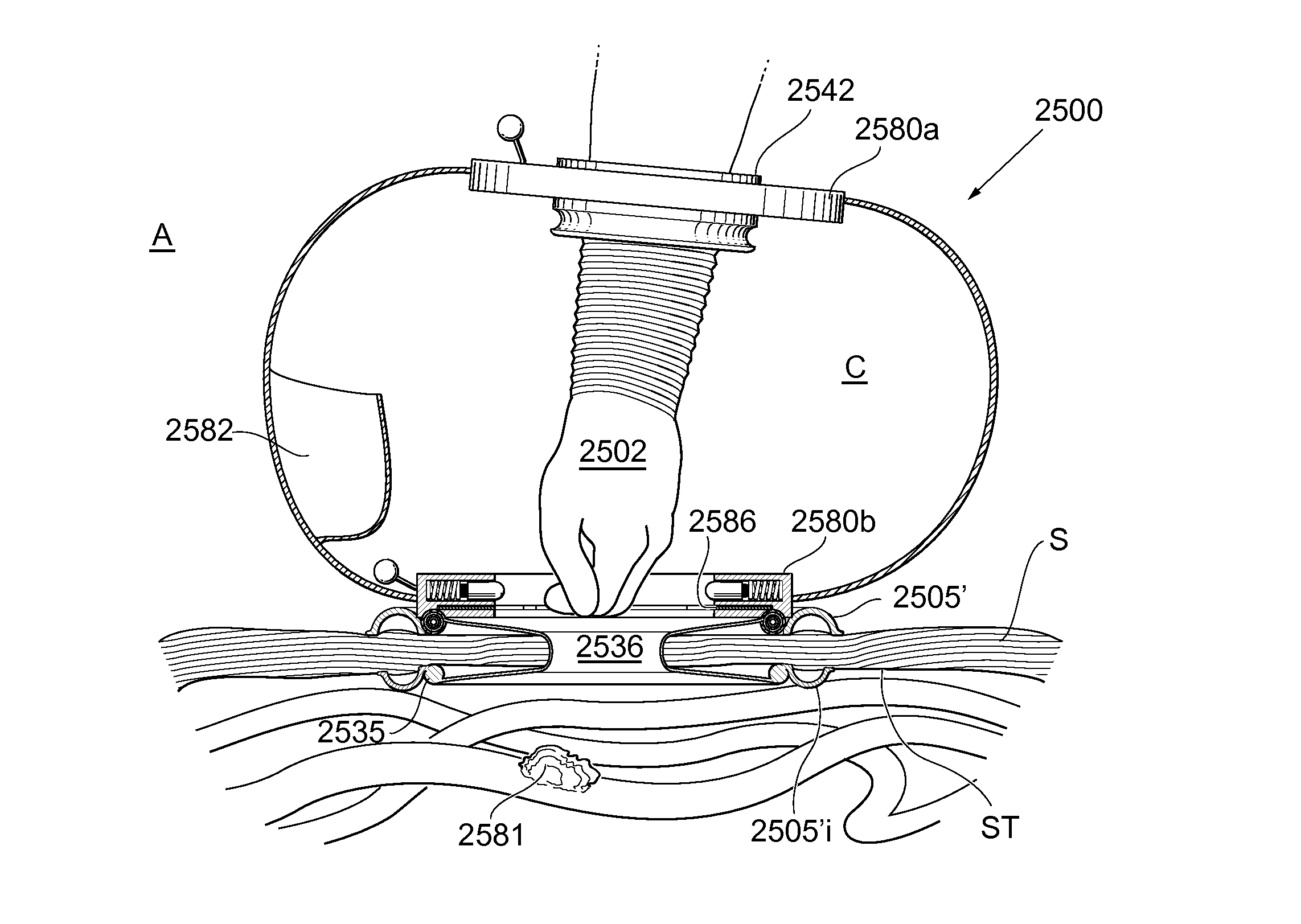 Surgical assisting device