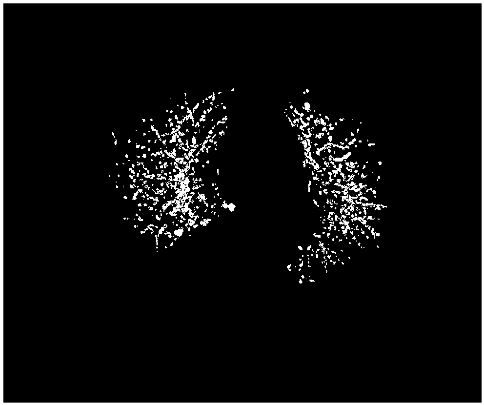 Automatic extraction of silicosis nodules from CT images