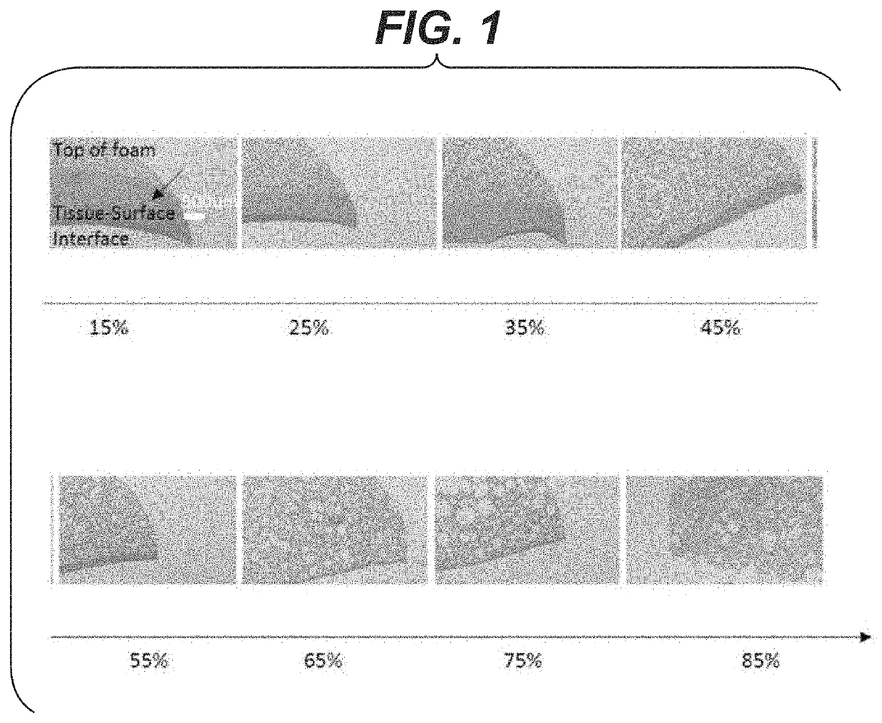 Sealant foam compositions for lung applications