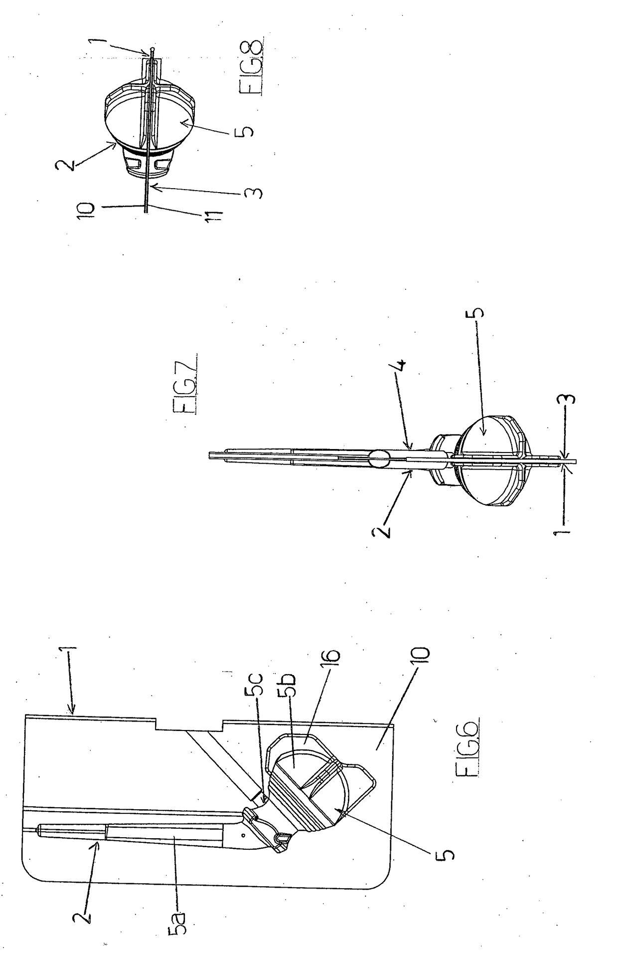Mould for realizing a temporary prosthesis of hip or shoulder, and method thereof