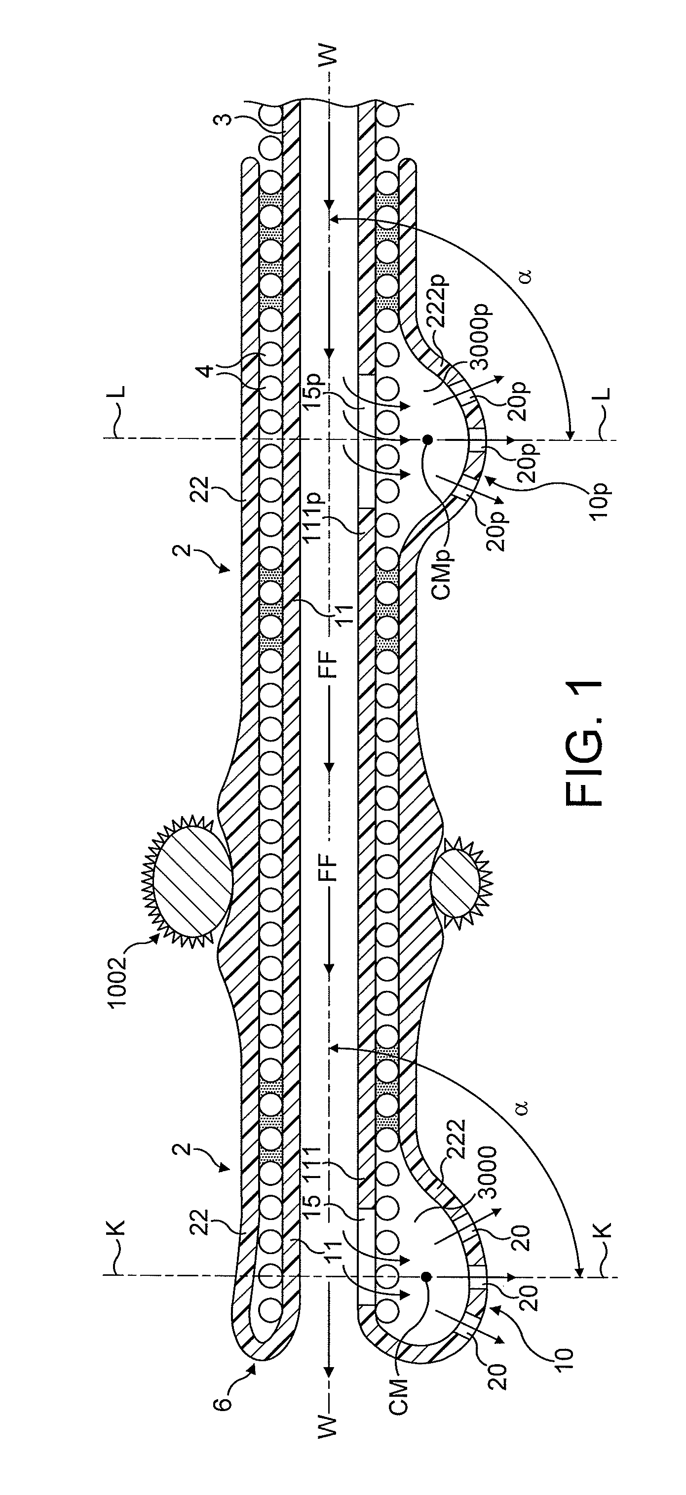 Rotational atherectomy device with fluid inflatable support elements supported by fluid bearings