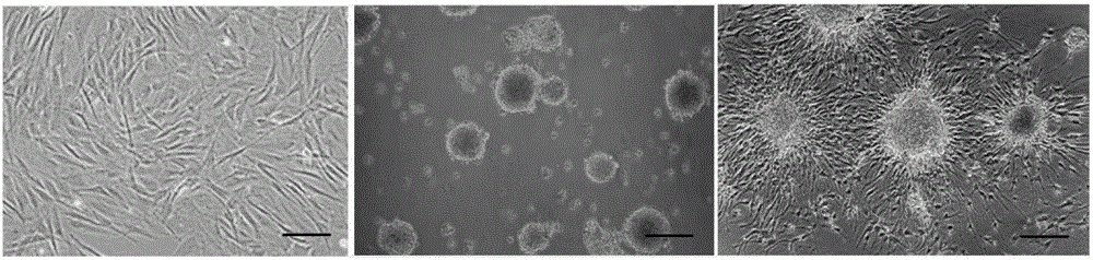 A method of three-dimensional culture and differentiation of human adipose-derived mesenchymal stem cells into neural-like stem cells