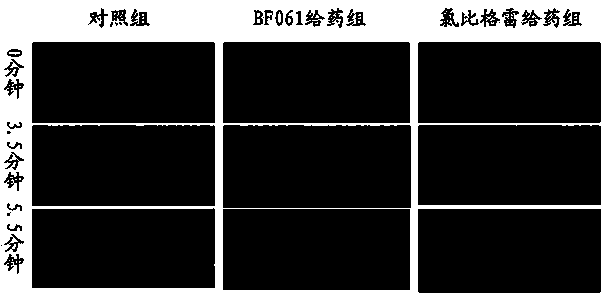 Bi-functional antiplatelet aggregation medicine and application thereof