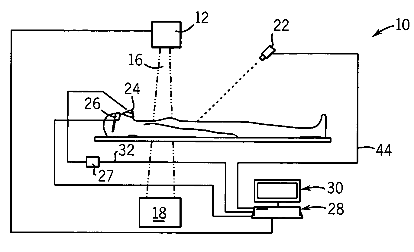 Apparatus and method using synchronized breathing to treat tissue subject to respiratory motion