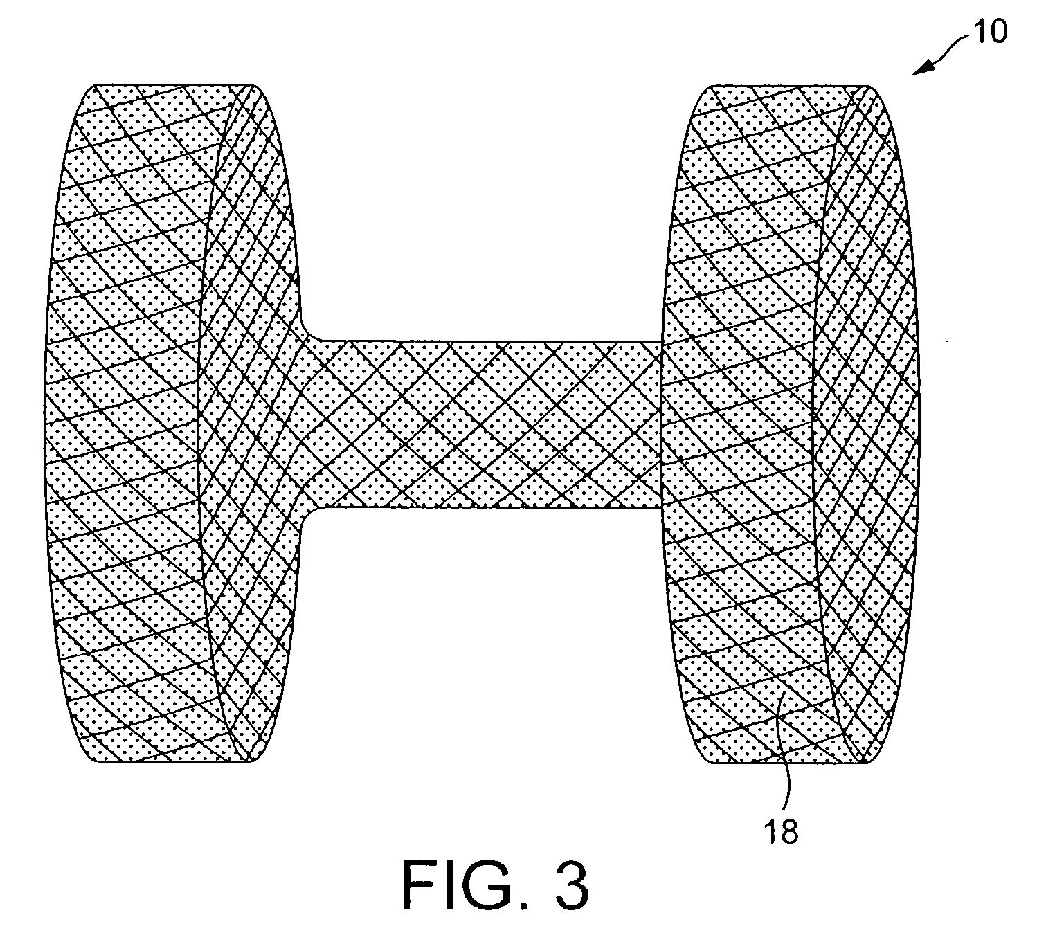 Method And Apparatus For Treatment Of Cardiac Valves