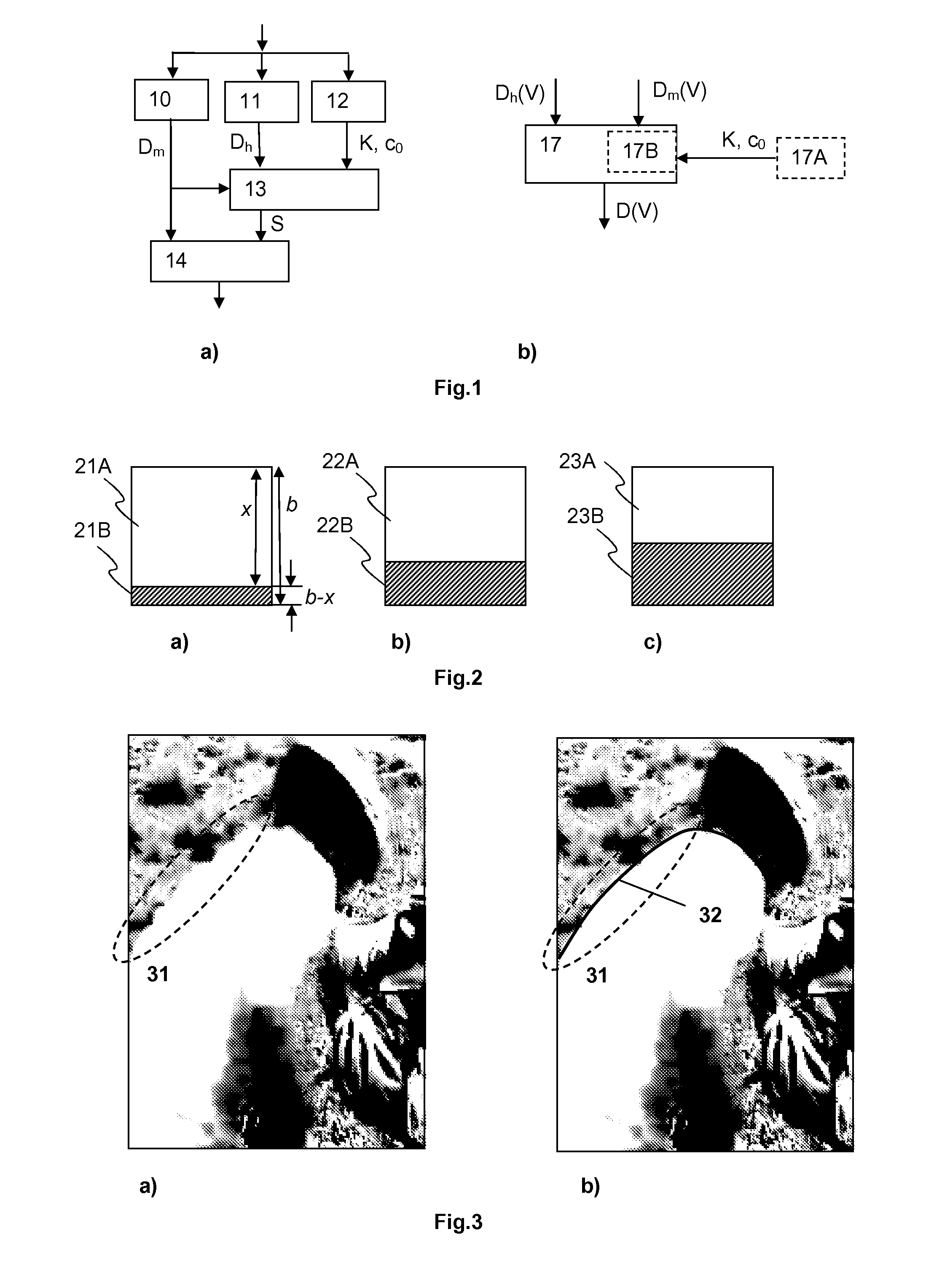 Method and device for calculating distortion of a video being affected by compression artifacts and channel artifacts
