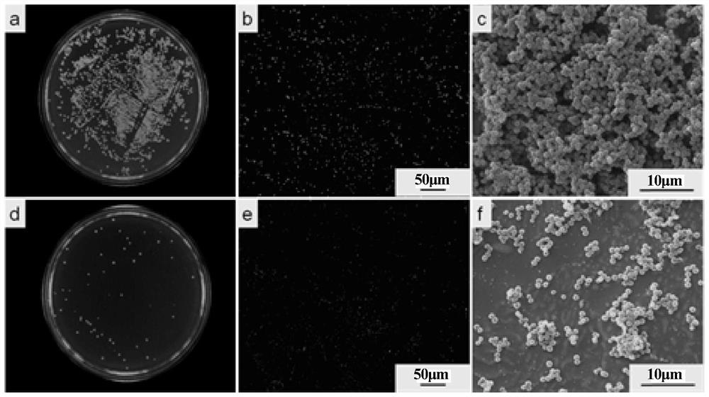 Degradable anti-infection and anti-calculus fe-cu alloys suitable for urinary implant materials