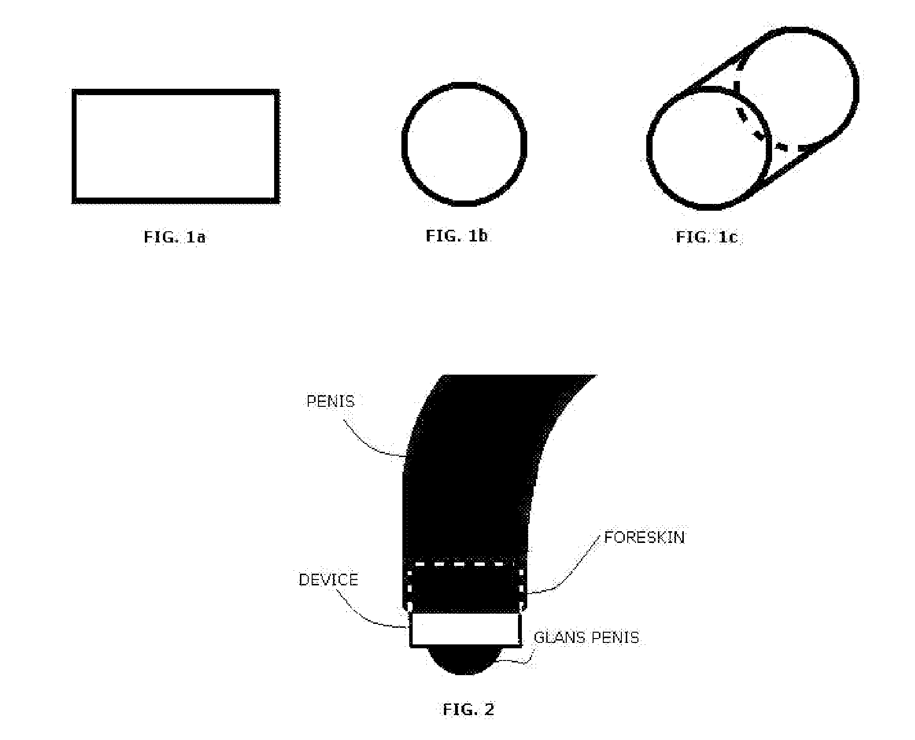 Device for prophylactics and treatment of balanitis