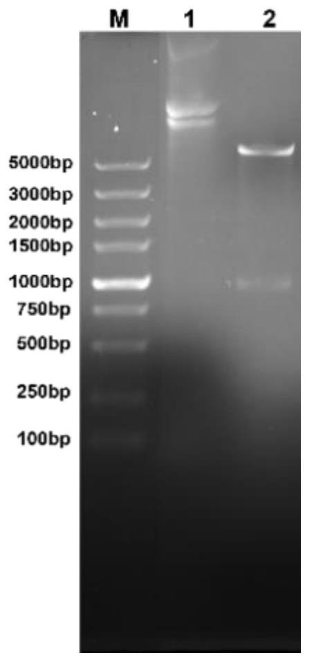 Echinococcus granulosus recombinant protein EgG1Y162-2 (4) and application thereof