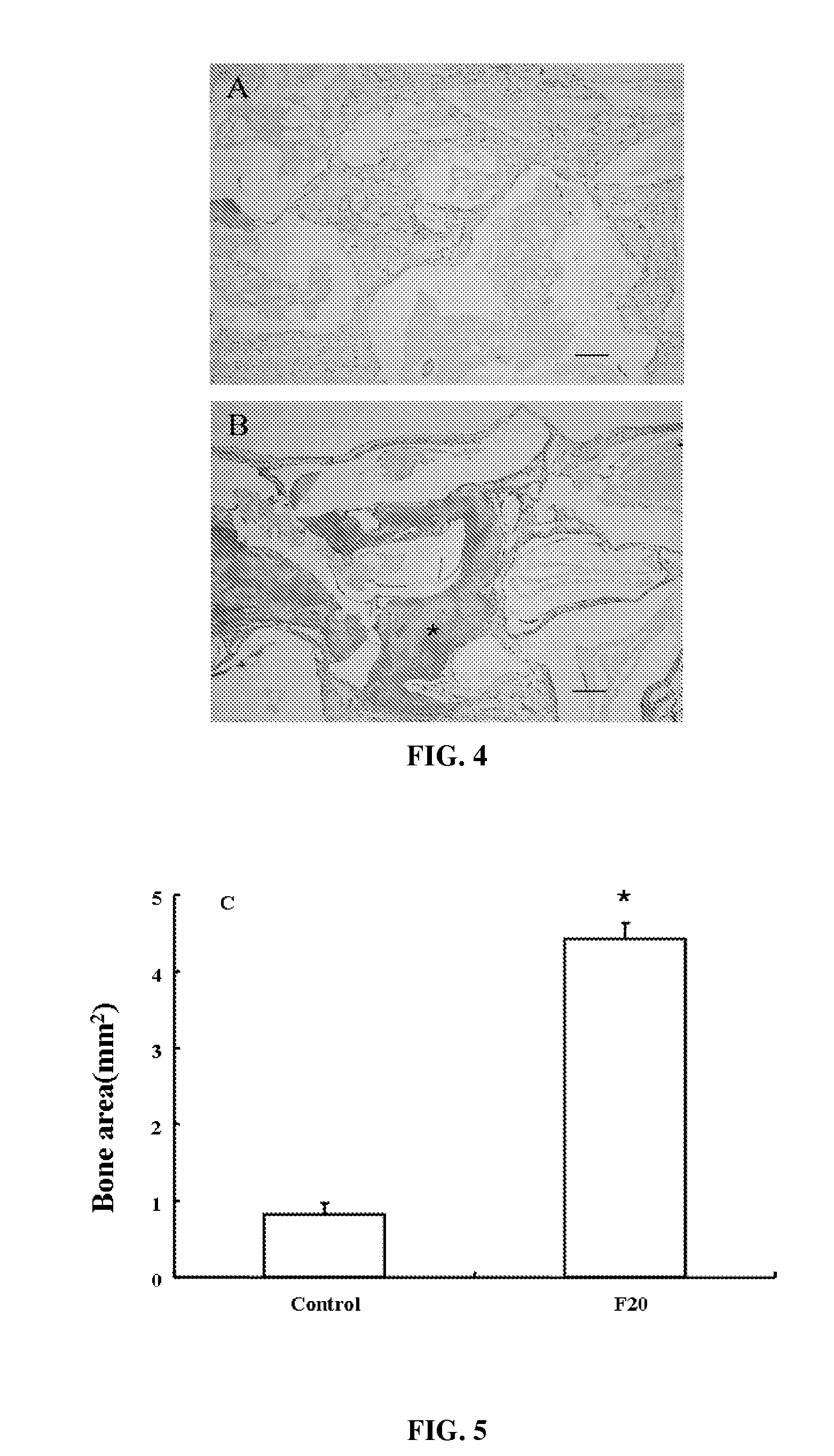 Composition of bone formation with PHSRN-RGD containing oligopeptide