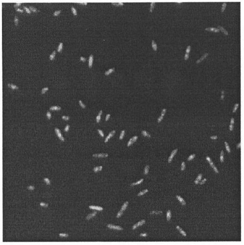 A method for preparing and regenerating protoplasts of Welan gum synthetic bacteria