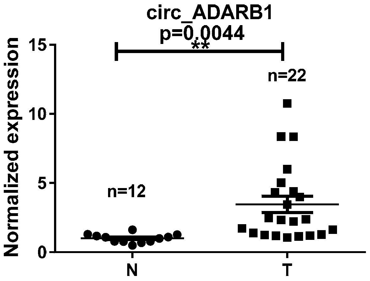 Application of circ_ADARB1 in preparing nasopharyngeal carcinoma therapeutic preparation and therapeutic preparation