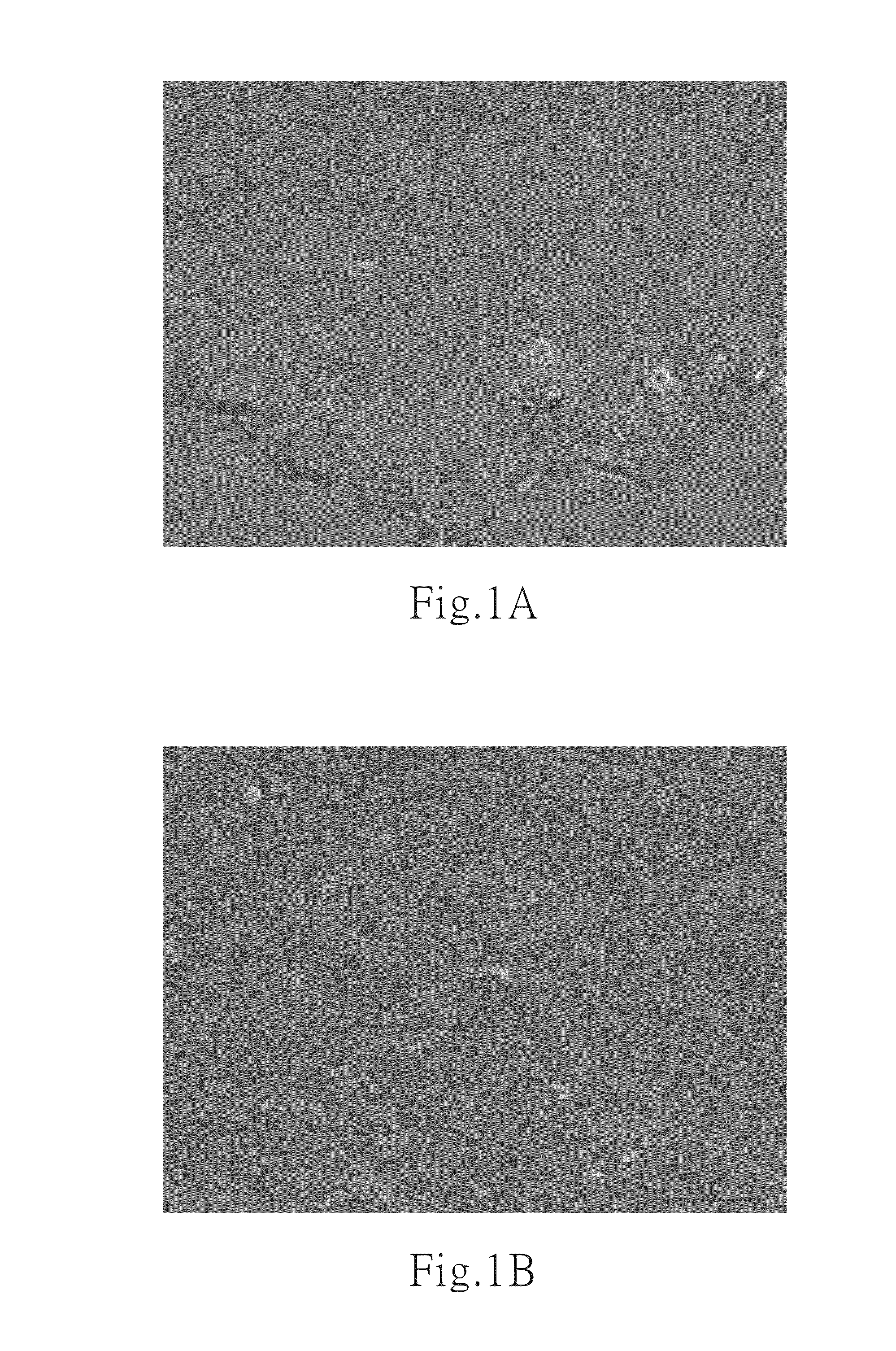 Culture medium and method for inducing differentiation of pluripotent stem cells into neuroepithelial cells