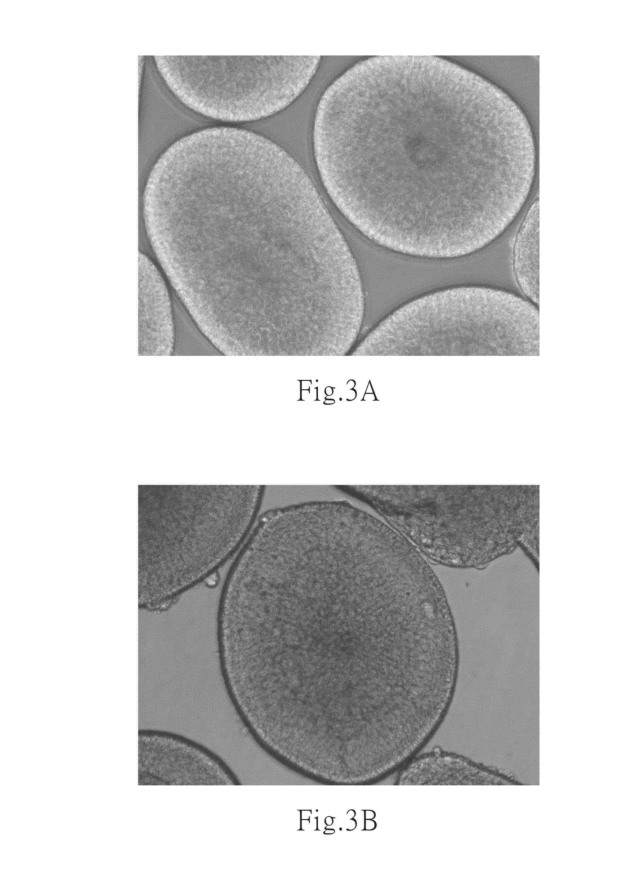 Culture medium and method for inducing differentiation of pluripotent stem cells into neuroepithelial cells