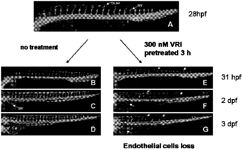 Zebra fish vascular injury model for screening vascular injury resisting medicament as well as building method and application thereof