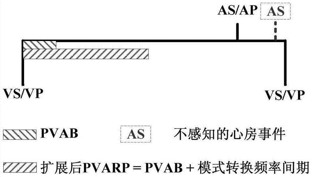 A Low-Power Method for Realizing Mode Inversion of Implantable Pacemaker