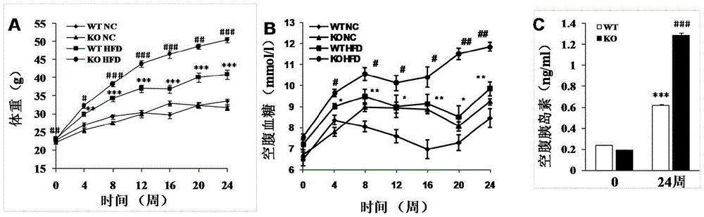 Function and application of centrifugal force and shear stress response gene 1 in fatty liver and diabetes