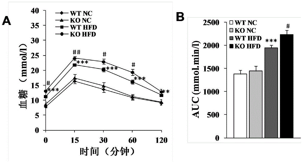 Function and application of centrifugal force and shear stress response gene 1 in fatty liver and diabetes