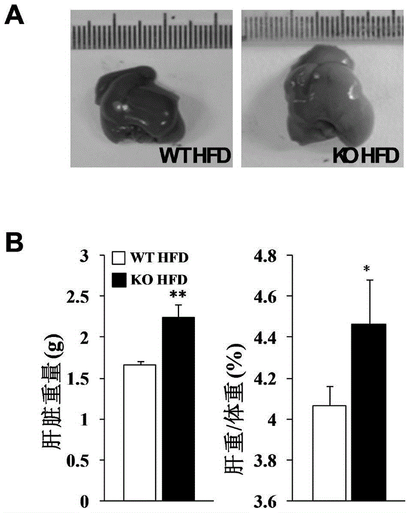 Function and application of centrifugal force and shear stress response gene 1 in fatty liver and diabetes