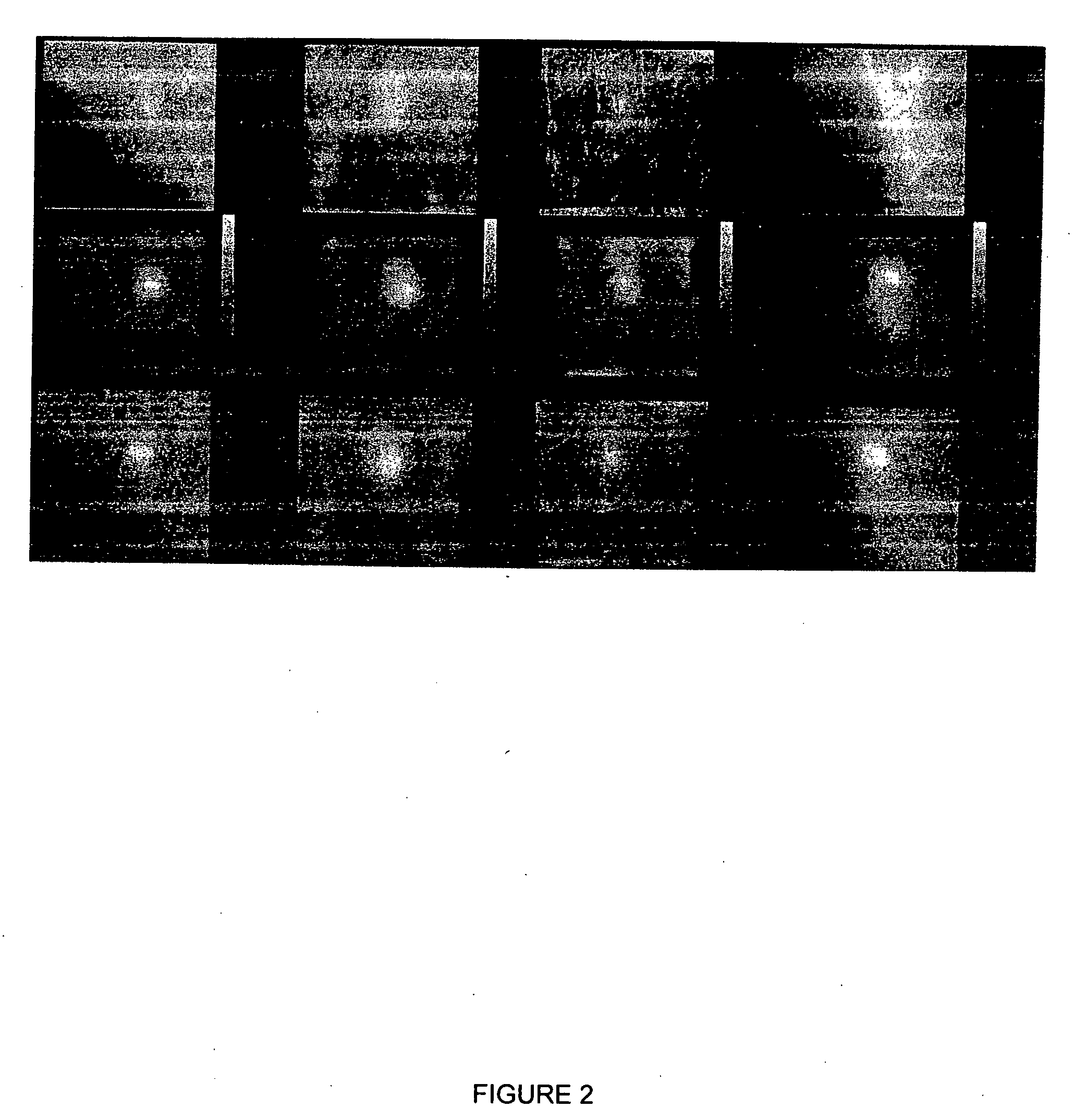 Method and apparatus for combined gamma/x-ray imaging in stereotactic biopsy