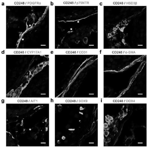 Separation and culture method of human testicular mesenchymal stem cells