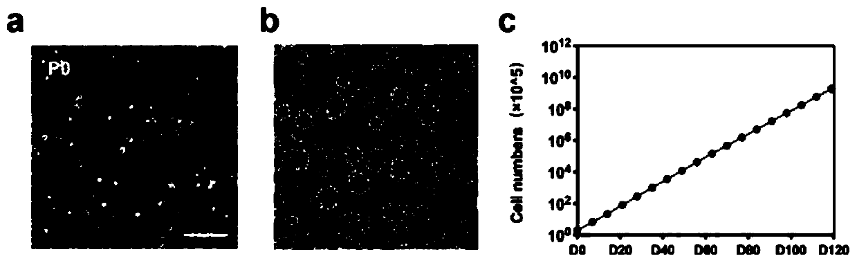 Separation and culture method of human testicular mesenchymal stem cells