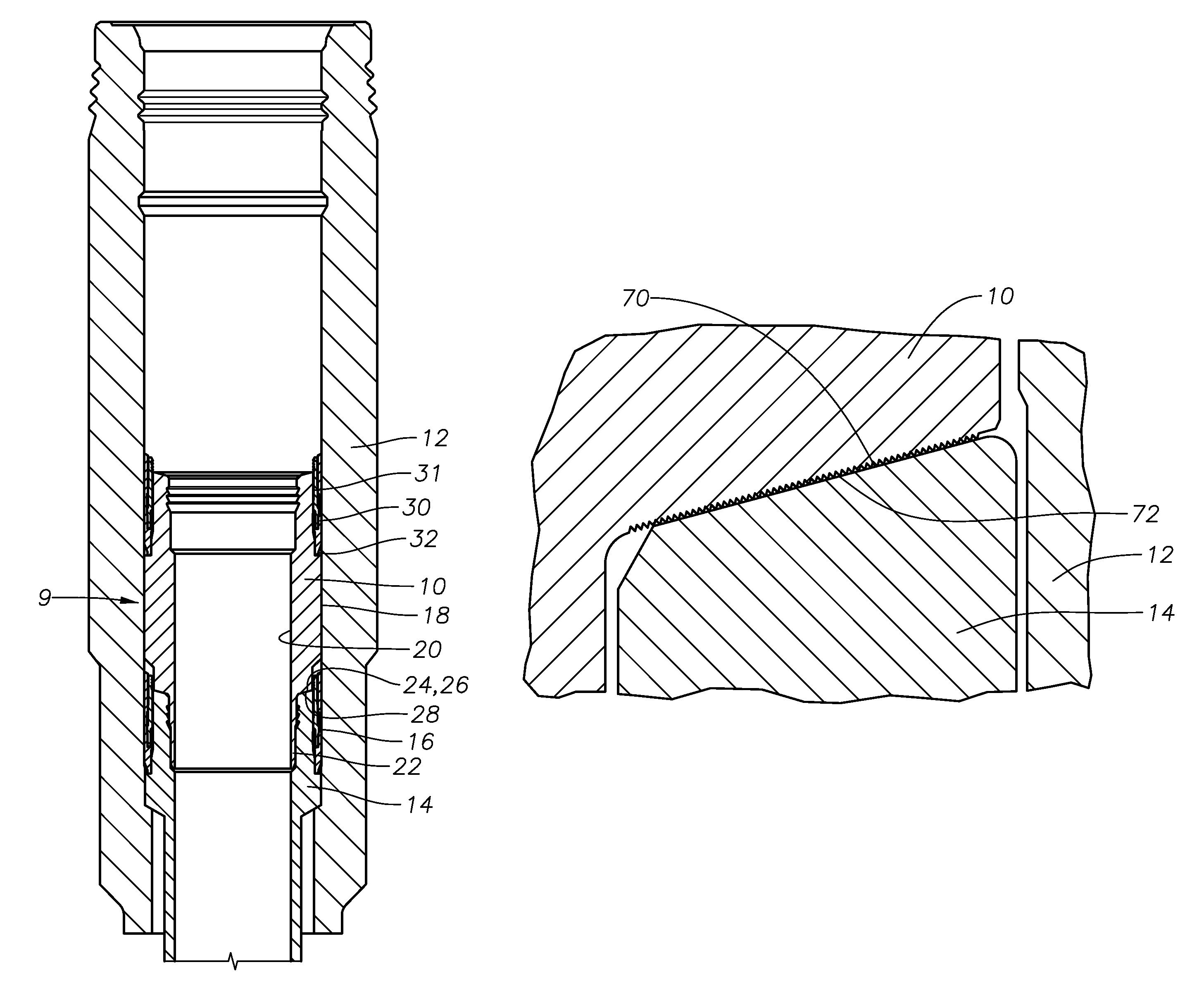 Wicker-type face seal and wellhead system incorporating same