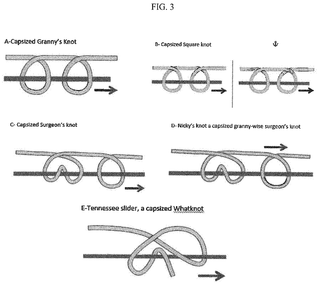 Device and method for intracorporeal and extracorporeal laparoscopic suturing and knot tying